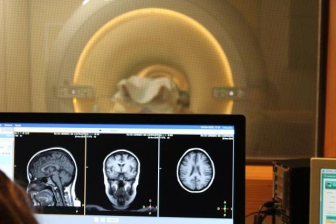 El Hospital de Albacete incrementa un 73 por ciento las resonancias magnéticas en un semestre