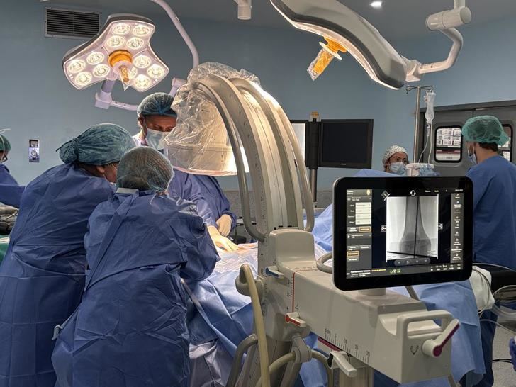 Avance en Albacete: Primera cirugía de alargamiento óseo con clavo intramedular para adolescentes