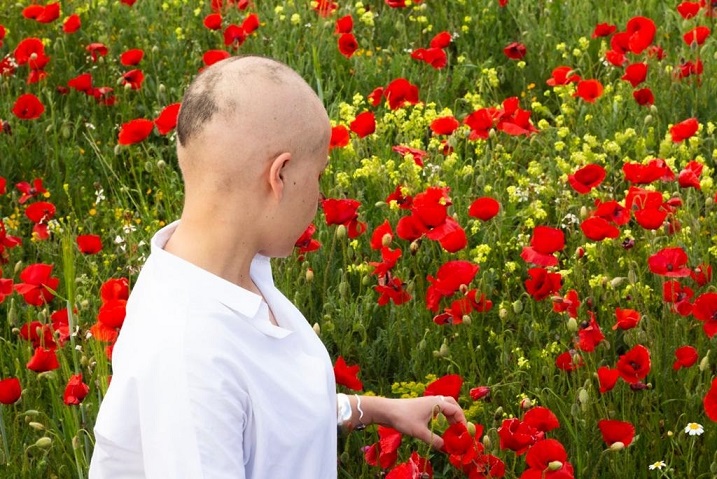 El Ayuntamiento de Albacete promueve una campaña con talleres y una exposición de fotografía para hacer visible la alopecia femenina