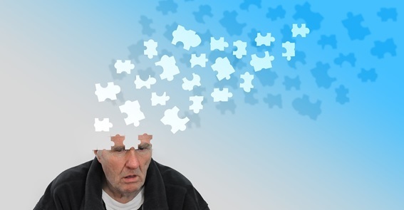 Mal de Alzheimer: enfermedad que progresiva y que deteriora la capacidad cognitiva