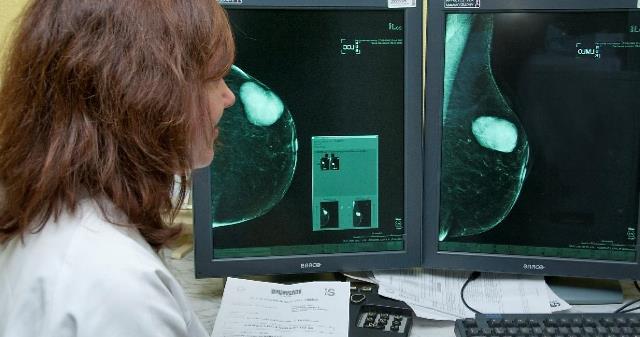 121.000 mujeres participaron en el programa de detección de cáncer mama en Castilla-La Mancha