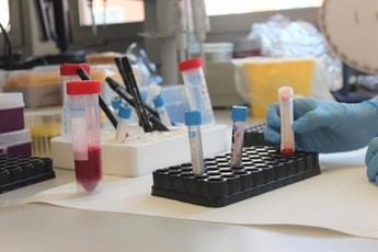 Actualización de precios en analíticas de Salud Pública en Castilla-La Mancha