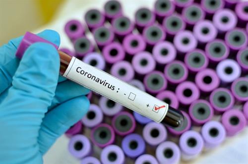 Sanidad recomienda hacer test de coronavirus a los pacientes que vayan a ser intervenidos