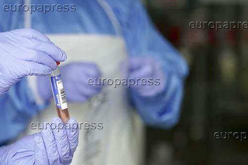 Confirmados 10 positivos de 238 pruebas PCR realizadas en el asentamiento de Albacete