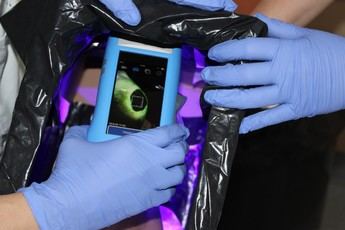 Alcázar mejora el tratamiento de heridas complejas con tecnología innovadora