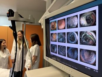 El Hospital de Almansa lidera en la detección temprana de lesiones digestivas con cromoendoscopia