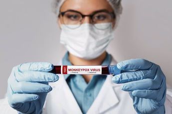 C-LM registra 42 de los 5.792 casos de viruela del mono contabilizados en España, 73 más que el viernes según Sanidad