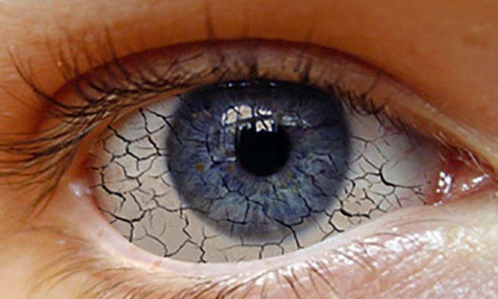 Los farmacéuticos alertan del incremento de casos de ojo seco asociados al COVID-19