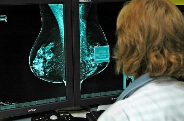 El Hospital General de Ciudad Real realiza más de 800 mamografías en 3D en el último trimestre