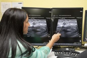 El Hospital de Guadalajara introduce la termoablación con microondas para tratar tumores de mama en mujeres que no pueden ser operadas